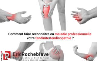 Comment faire reconnaître en maladie professionnelle votre tendinite/tendinopathie ?